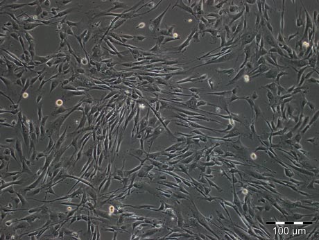 Urine Derrived Stem Cells